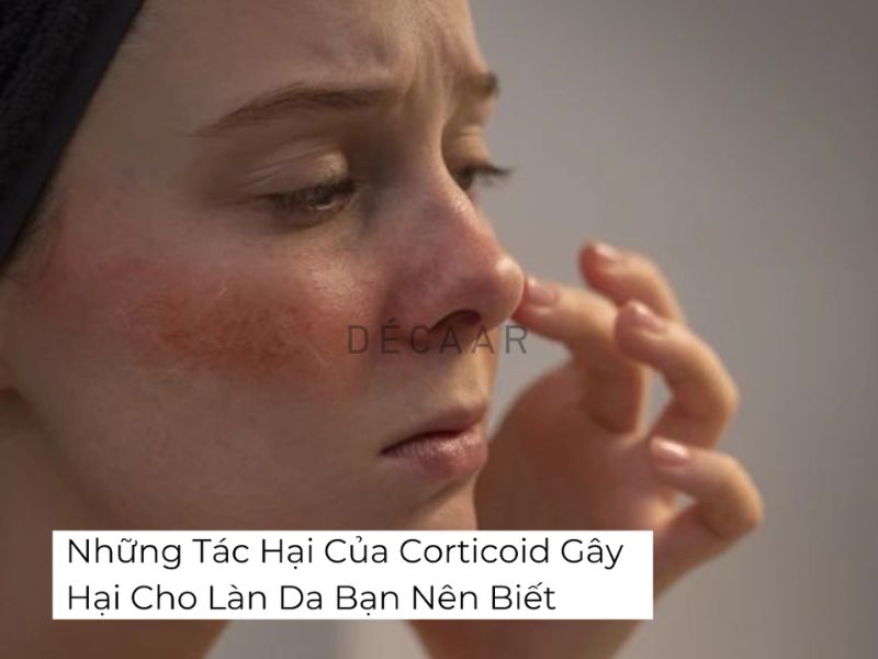 tác hại của corticoid trên da